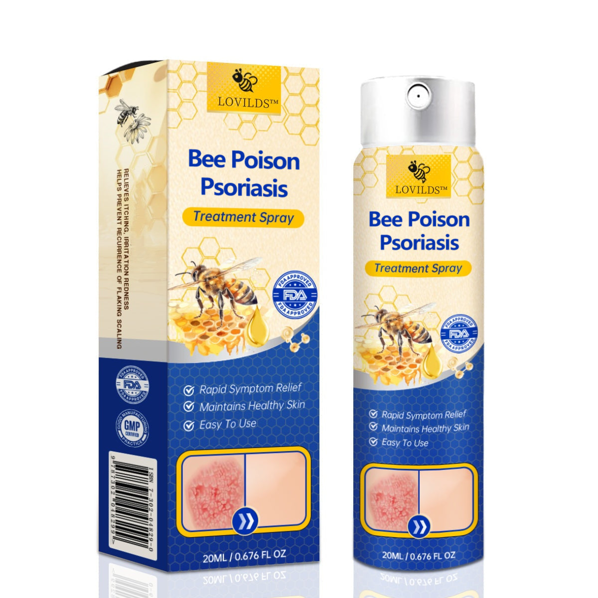 【Official Brand Store】PsoriaHeal Psoriasis Spray Pro