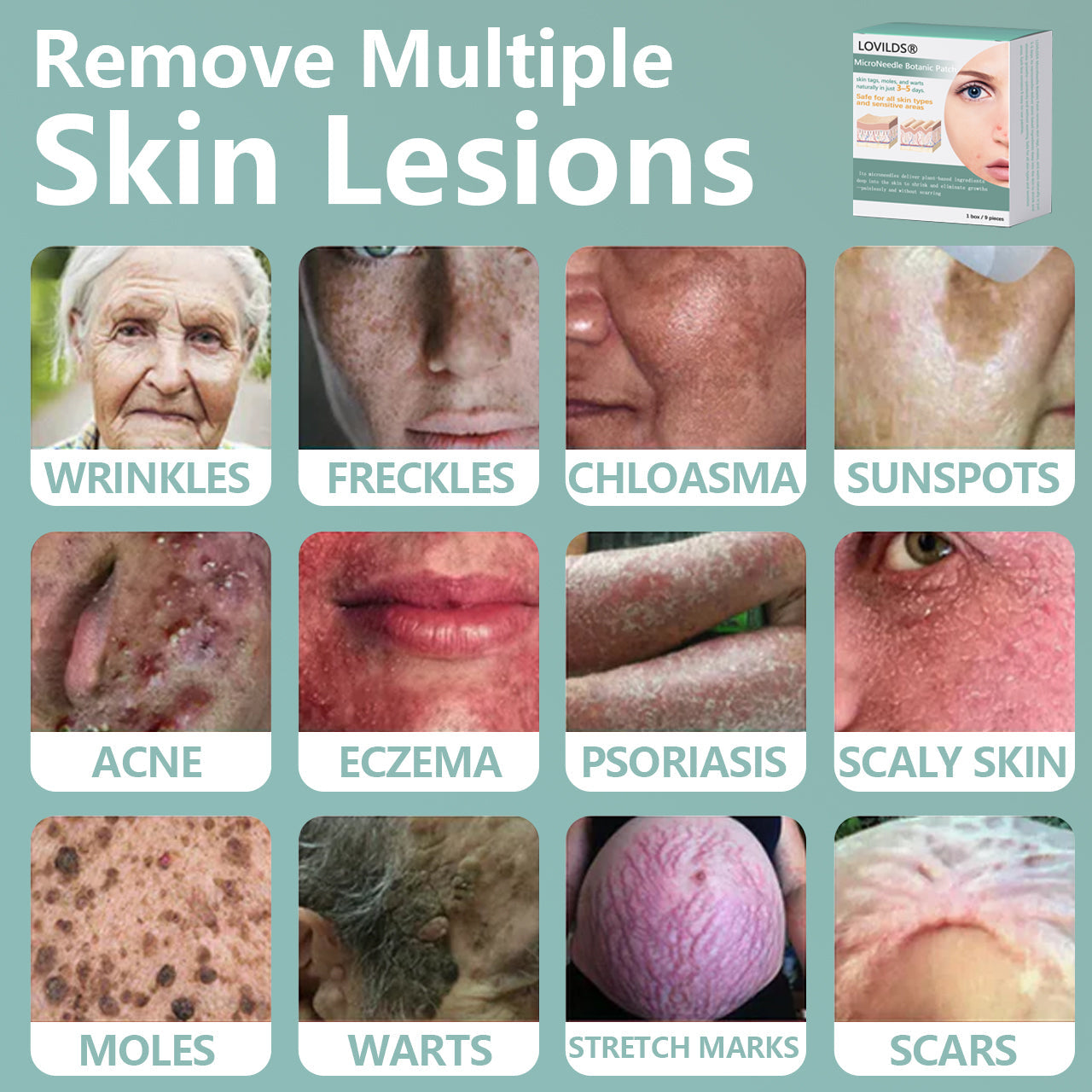 šLOVILDSĀ® MicroNeedle Botanic Skin Tag Removal Patch Made in the USA