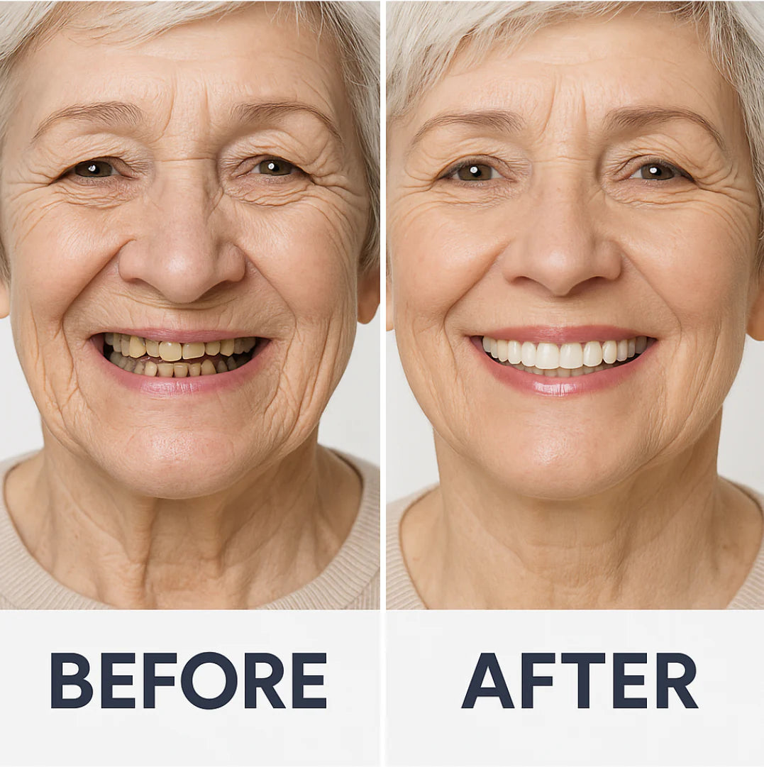 NESLEMY™ Advanced Customized Full Denture Set