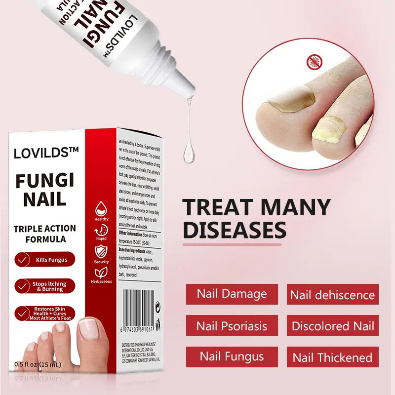 LOVIDS™Powerful toenail fungus treatment, antifungal solution for toenails or fingernails, triple action formula removes fungus, repairs and renews damaged nails