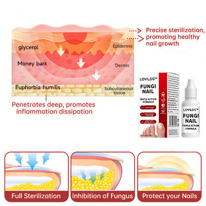 LOVIDS™Powerful toenail fungus treatment, antifungal solution for toenails or fingernails, triple action formula removes fungus, repairs and renews damaged nails