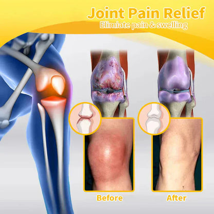BBOJI™ Botulinum Toxin Rapid Therapy Joint Cream｜Deep Penetration for Joint Repair