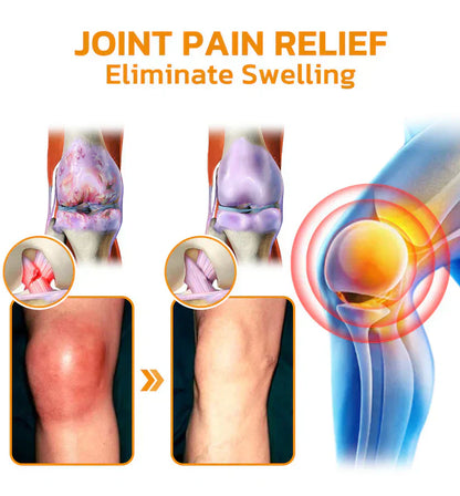 BBOJI™ Botulinum Toxin Rapid Therapy Joint Cream｜Deep Penetration for Joint Repair