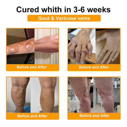 AQA™ Botulinum Toxin & Bee Essence Pain-Relief Bone Healing Cream