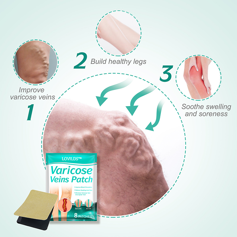 ✨ Last Day Discount: 80% OFF 🌸 LOVILDS™ Leech Varicose Veins Patch