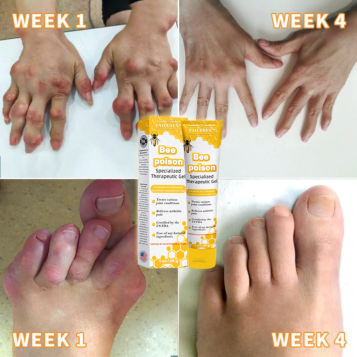 TAILEDEN™  Bee poison Joint Therapy Pain Relief Gel