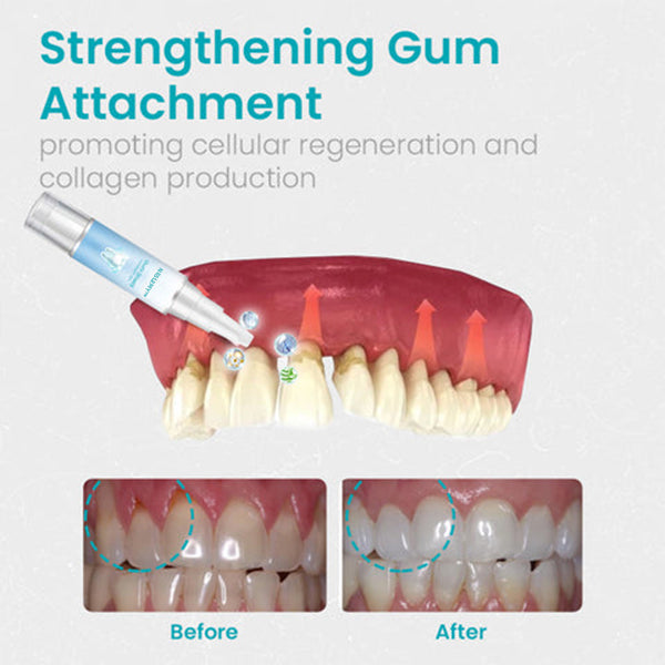 🦷🔥Last Day Promotion 80% OFF-LOVILDS™ Gum Shield Therapy Gel