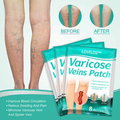 ✨ Last Day Discount: 80% OFF 🌸 LOVILDS™ Leech Varicose Veins Patch