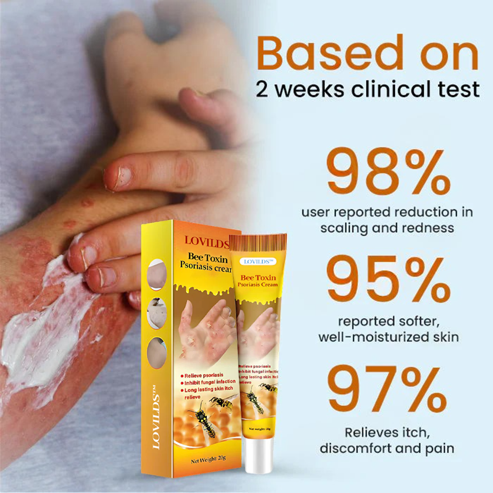 LOVILDS™ Bee Toxin Psoriasis Cream – Fast-Acting, Steroid-Free Relief for Itching, Scaling, and Redness | Dermatologist-Approved, Long-Lasting Hydration & Infection Prevention
