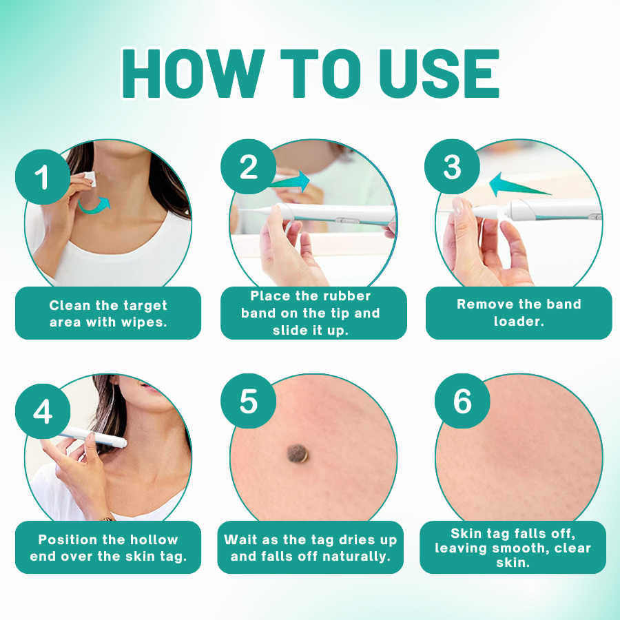 LOVILDS™ 2-in1 Skin Tag Removal Kit