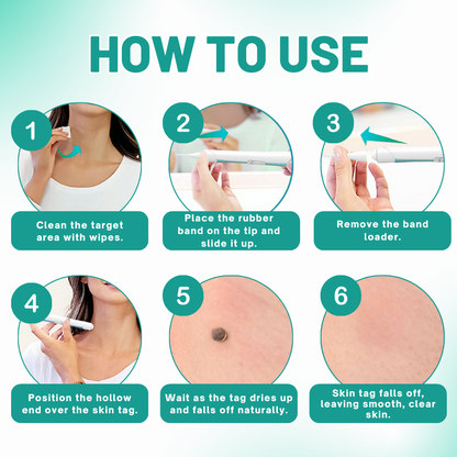 LOVILDS™ 2-in1 Skin Tag Removal Kit