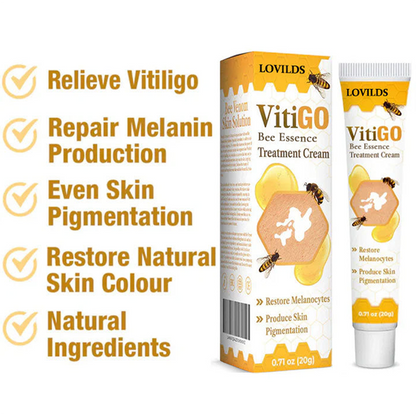 LOVILDS™ Bee Essence Vitiligo Treatment Cream