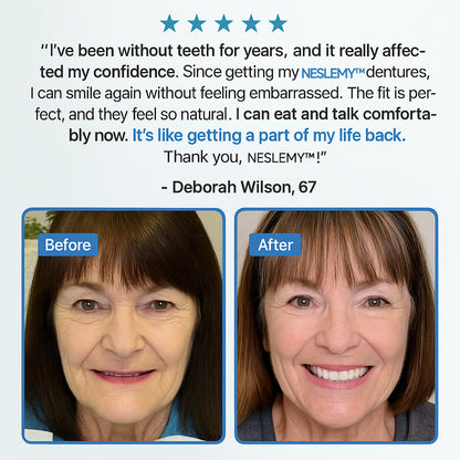 NESLEMY™ Adsorptive Denture