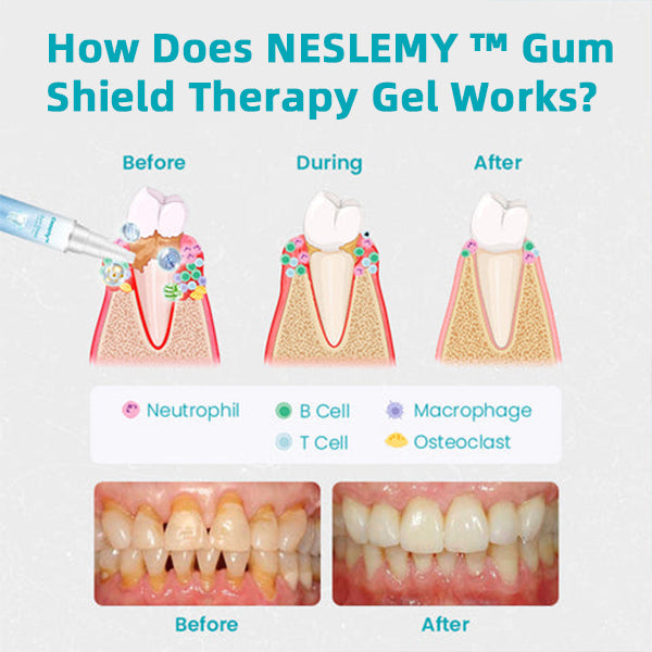 🦷🔥Last Day Promotion 80% OFF-LOVILDS™ Gum Shield Therapy Gel