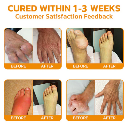 BBOJI™ Botulinum Toxin Rapid Therapy Joint Cream｜Deep Penetration for Joint Repair