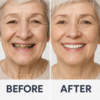 NESLEMY™  Advanced Customized Full Denture Set