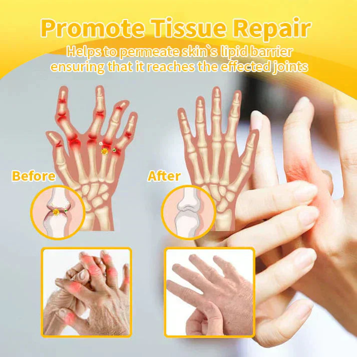 BBOJI™ Botulinum Toxin Rapid Therapy Joint Cream｜Deep Penetration for Joint Repair