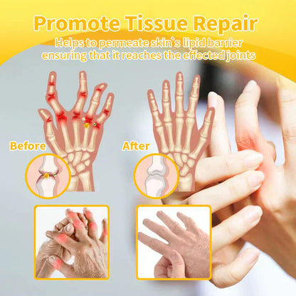 BBOJI™ Botulinum Toxin Rapid Therapy Joint Cream｜Deep Penetration for Joint Repair