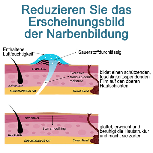 LOVILDS™ Erweiterte Narbenentfernung Gel