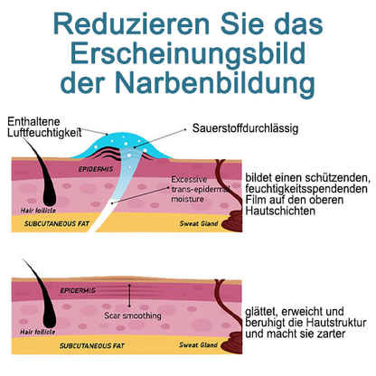 LOVILDS™ Erweiterte Narbenentfernung Gel