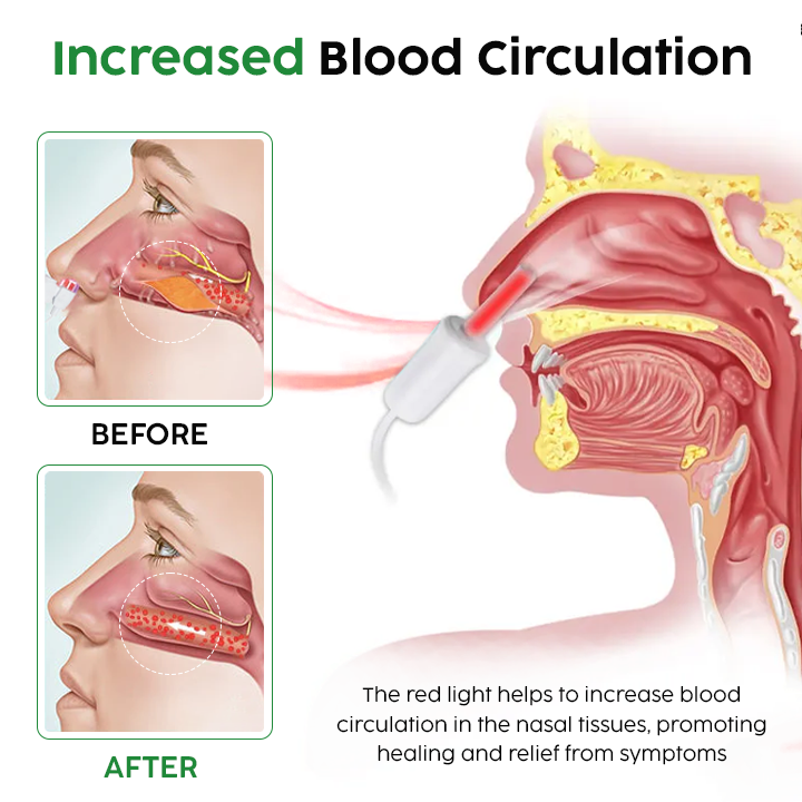 QIAWI™  Nasal LED Therapy Device