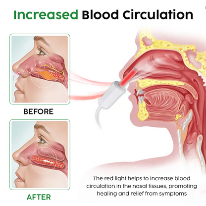 QIAWI™  Nasal LED Therapy Device