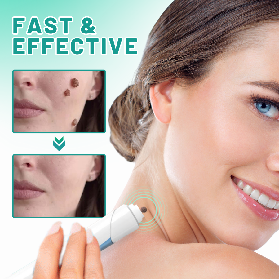 LOVILDS™ 2-in1 Skin Tag Removal Kit