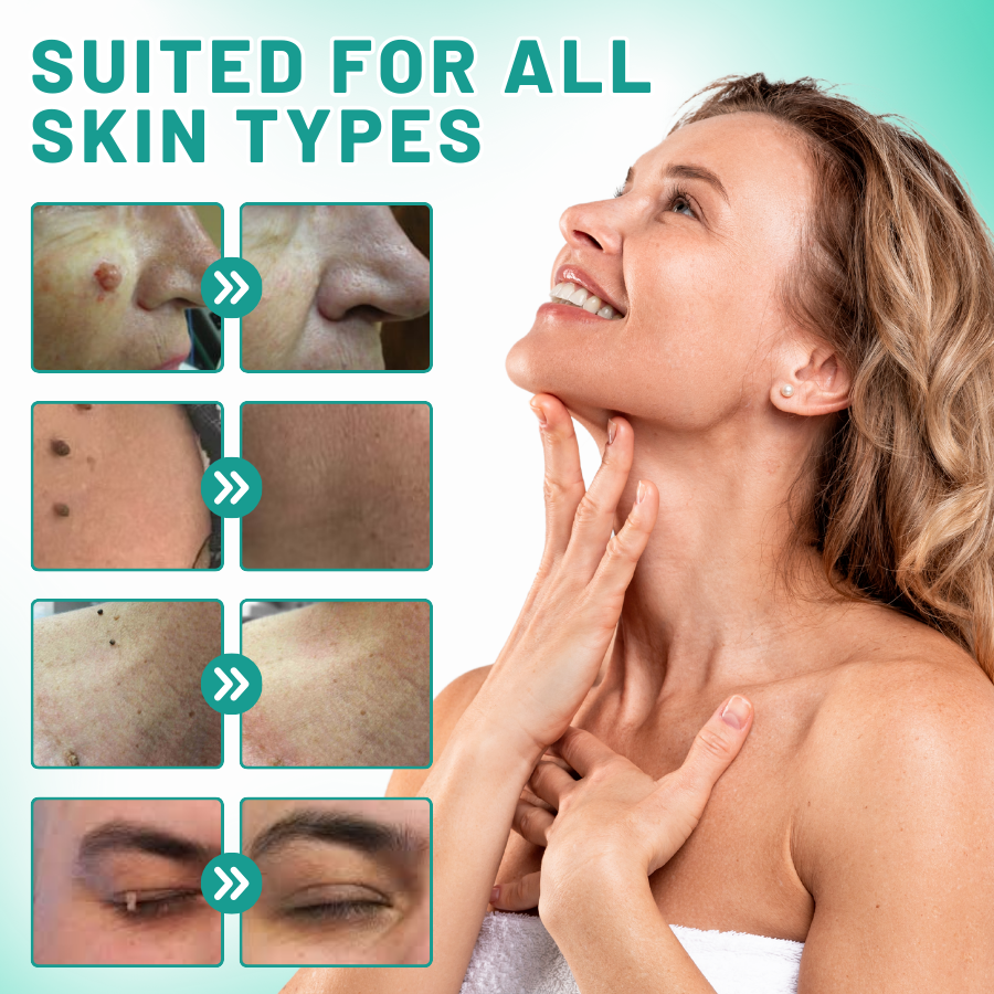 LOVILDS™ 2-in1 Skin Tag Removal Kit