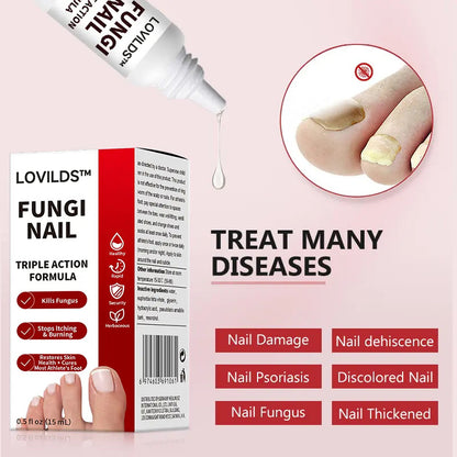 LOVIDS™Powerful toenail fungus treatment, antifungal solution for toenails or fingernails, triple action formula removes fungus, repairs and renews damaged nails