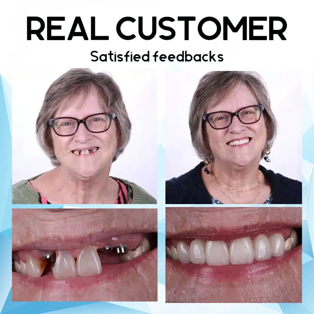 QIAWI™- Premium Custom Silicone Denture Set Dual Certification by the American Dental Association (ADA) & the U.S. Food and Drug Administration (FDA)